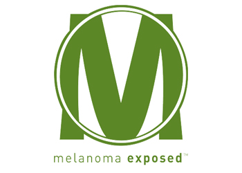 Melanoma Exposed